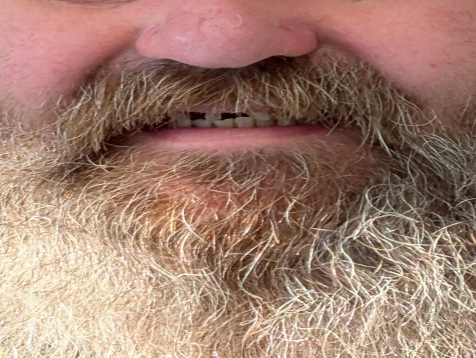 before_resized_2048x1541 (1)